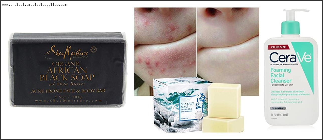 Best Soap For Pimples Oily Skin